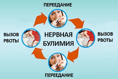 Лечение булимии в Горно-Алтайске